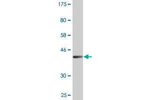 Western Blot detection against Immunogen (41. (TSC22D1 anticorps  (AA 1-144))