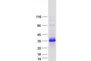 Validation with Western Blot (TMEM221 Protein (Myc-DYKDDDDK Tag))