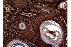 Immunohistochemistry (IHC) analysis of paraffin-embedded Human Skin, antibody was diluted at 1:100.