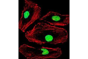 Immunofluorescence (IF) image for anti-Methyl-CpG Binding Domain Protein 2 (MBD2) antibody (ABIN3001197)