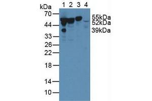Figure. (Vitamin D-Binding Protein anticorps  (AA 209-401))