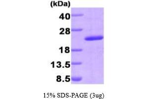 SDS-PAGE (SDS) image for Peptidylprolyl Isomerase G (Cyclophilin G) (PPIG) (AA 1-175) protein (His tag) (ABIN666915) (PPIG Protein (AA 1-175) (His tag))