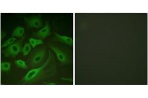 Immunofluorescence analysis of HeLa cells, using PLB (Ab-16/17) Antibody. (Phospholamban anticorps  (AA 1-50))
