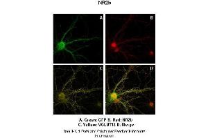 Sample Type :  Rat Hippocampal Neurons - 14DIV  Primary Antibody Dilution :  1:200  Secondary Antibody :  Anti-rabbit-Cy3  Secondary Antibody Dilution :  1:500  Color/Signal Descriptions :  Green: GFP Red: NR2b Yellow: VGLUT12  Gene Name :  GRIN2B  Submitted by :  Dan Fowler - University of Oregon, Institute of Neuroscience