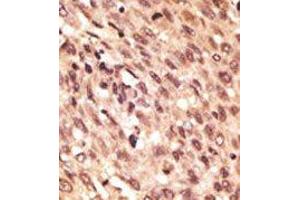 Image no. 1 for anti-Low Density Lipoprotein Receptor-Related Protein 5 (LRP5) (C-Term) antibody (ABIN358635) (LRP5 anticorps  (C-Term))