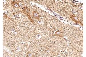 ABIN6268819 at 1/100 staining human brain tissue sections by IHC-P. (EPH Receptor B4 anticorps  (Internal Region))