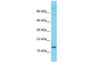Host: Rabbit Target Name: C9orf57 Sample Type: Fetal Kidney lysates Antibody Dilution: 1. (C9ORF57 anticorps  (N-Term))