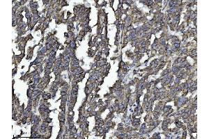 IHC analysis of DBN1 using anti-DBN1 antibody (ABIN7602637). (DBN1 anticorps  (AA 9-649))