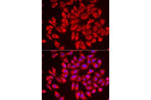Immunofluorescence analysis of U2OS cells using DCAF7 antibody (ABIN6293269). (DCAF7 anticorps)