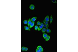 Immunofluorescent analysis of PC-3 cells using ABIN7164210 at dilution of 1:100 and Alexa Fluor 488-congugated AffiniPure Goat Anti-Rabbit IgG(H+L) (PFDN2 anticorps  (AA 1-154))