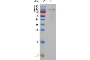 Human ADA Protein, His Tag on SDS-PAGE under reducing condition.