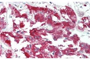 Detection of MERTK in Human Adrenal gland Tissue using Polyclonal Antibody to C-Mer Proto Oncogene Tyrosine Kinase (MERTK) (MERTK anticorps  (AA 587-858))