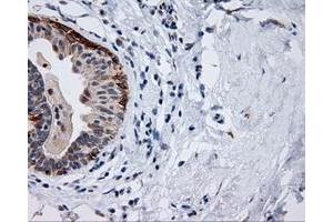 Immunohistochemistry (IHC) image for anti-Induced Myeloid Leukemia Cell Differentiation Protein Mcl-1 (MCL1) antibody (ABIN1499338)