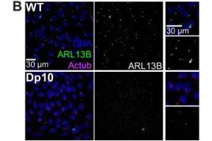 Primary cilium formation in hTERT-RPE1 cells treated with siRNA: control (a), UBQLN4 (b), BAG6 (c), and RNF126 (d).