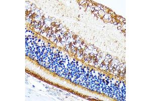 Immunohistochemistry of paraffin-embedded rat retina using CRALBP Rabbit mAb (ABIN7269934) at dilution of 1:100 (40x lens).