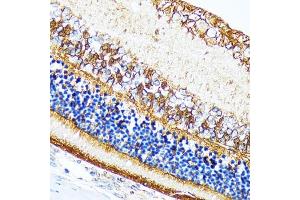 Immunohistochemistry of paraffin-embedded rat retina using CRALBP Rabbit mAb (ABIN7269934) at dilution of 1:100 (40x lens). (RLBP1 anticorps)
