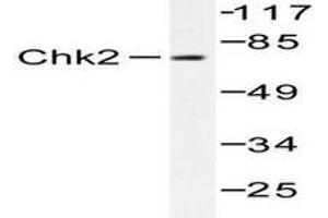 Image no. 1 for anti-Checkpoint Kinase 2 (CHEK2) antibody (ABIN265350) (CHEK2 anticorps)