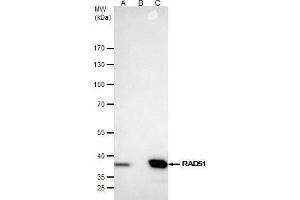 IP Image Rad51 antibody [N1C2] immunoprecipitates Rad51 protein in IP experiments.