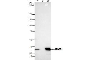 IP Image Rad51 antibody [N1C2] immunoprecipitates Rad51 protein in IP experiments. (RAD51 anticorps  (Center))