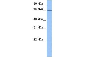 WB Suggested Anti-NOL5A Antibody Titration: 1 ug/mlPositive Control: 721_B cell lysate NOP56 is supported by BioGPS gene expression data to be expressed in 721_B (NOP56 anticorps  (Middle Region))
