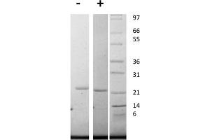 SDS-PAGE of Human Interleukin-11 Recombinant Protein SDS-PAGE of Human Interleukin-11 Recombinant Protein. (IL-11 Protéine)