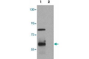 Western blot analysis of KAL1 in MCF-7 cell lysate with KAL1 polyclonal antibody  at 1 ug/mL. (KAL1 anticorps  (Internal Region))