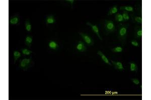 Immunofluorescence of monoclonal antibody to LDB2 on HeLa cell.