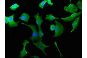 Immunofluorescence staining of U251 cells with ABIN7140082 at 1:50, counter-stained with DAPI.