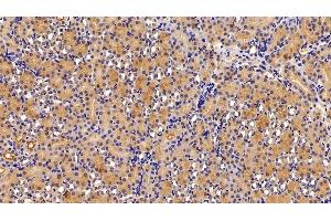 Detection of ALT in Mouse Kidney Tissue using Polyclonal Antibody to Alanine Aminotransferase (ALT)