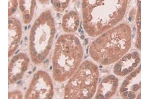 DAB staining on IHC-P; Samples: Human Kidney Tissue (ABCC10 anticorps  (AA 1246-1492))