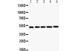 Anti-  NR1H3 antibody, Western blottingAll lanes: Anti NR1H3  at 0.