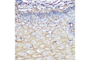 Immunohistochemistry of paraffin-embedded human esophageal using Annexin  Rabbit mAb (ABIN7265619) at dilution of 1:100 (40x lens). (Annexin A2 anticorps)