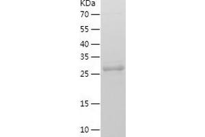 Western Blotting (WB) image for Secretagogin, EF-Hand Calcium Binding Protein (SCGN) (AA 2-276) protein (His-IF2DI Tag) (ABIN7124998)
