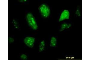 Image no. 2 for anti-Glial Cells Missing Homolog 1 (GCM1) (AA 108-166) antibody (ABIN599044) (GCM1 anticorps  (AA 108-166))