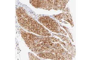 Immunohistochemical staining of human smooth muscle with ACTRT1 polyclonal antibody  shows strong cytoplasmic positivity in smooth muscle cells. (ACTRT1 anticorps)