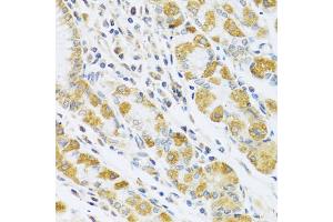 Immunohistochemistry of paraffin-embedded human stomach using PSG1 antibody (ABIN5973801) at dilution of 1/100 (40x lens). (PSG1 anticorps)