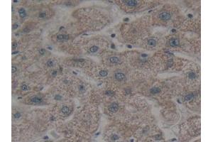 Detection of BMF in Human Liver Tissue using Polyclonal Antibody to Bcl2 Modifying Factor (BMF)