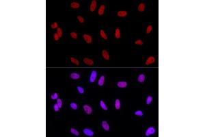 Immunofluorescence analysis of HeLa using AhR Rabbit mAb (ABIN7265679) at dilution of 1:100 (40x lens). (Aryl Hydrocarbon Receptor anticorps)