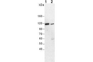 Western Blot of mouse kidney (lane 1) and brain (lane 2) using anti-α-Actinin-4, pAb (IG-701) .