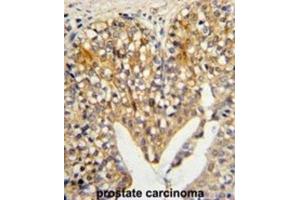 Immunohistochemistry (IHC) image for anti-Lumican (LUM) antibody (ABIN3003324)