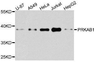 Western blot analysis of extracts of various cells, using PRKAB1 antibody. (PRKAB1 anticorps)