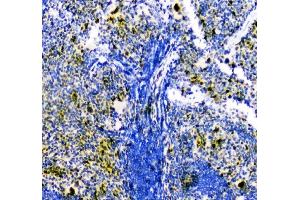 IHC analysis of ZEB2 using anti-ZEB2 antibody (ABIN3042325). (ZEB2 anticorps  (AA 1-200))