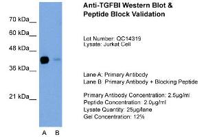 Host: Rabbit Target Name: TGFBI Sample Type: Jurkat Lane A: Primary Antibody Lane B: Primary Antibody + Blocking Peptide Primary Antibody Concentration: 2. (TGFBI anticorps  (C-Term))
