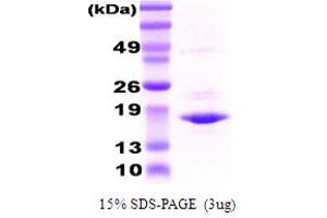 SDS-PAGE (SDS) image for Crystallin, alpha A (CRYAA) protein (ABIN666823)