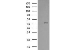 Image no. 2 for anti-Parvin, alpha (PARVA) antibody (ABIN1496441) (Parvin alpha anticorps)