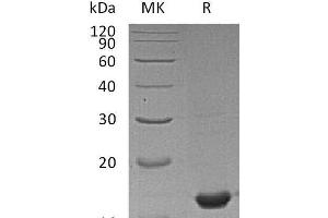 Western Blotting (WB) image for Peptidylprolyl Isomerase A (Cyclophilin A) (PPIA) protein (ABIN7320728) (PPIA Protéine)