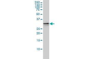 UBE2R2 monoclonal antibody (M01), clone 5E7 Western Blot analysis of UBE2R2 expression in Jurkat .