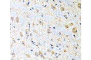 Immunohistochemistry of paraffin-embedded Mouse brain using MLN Polyclonal Antibody at dilution of 1:100 (40x lens). (Motilin anticorps)