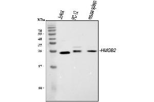 Western blot analysis of HMGB2 using anti-HMGB2 antibody (ABIN4886620). (HMGB2 anticorps  (N-Term))
