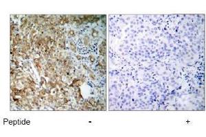 Image no. 1 for anti-Insulin-Like Growth Factor 1 Receptor (IGF1R) (Tyr1161) antibody (ABIN197242)